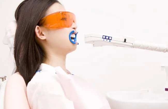 オフィスホワイトニング