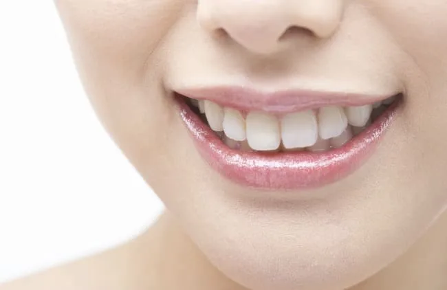 デュアルホワイトニング