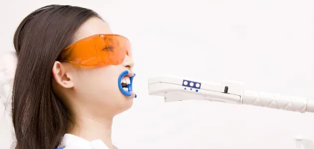 オフィスホワイトニング