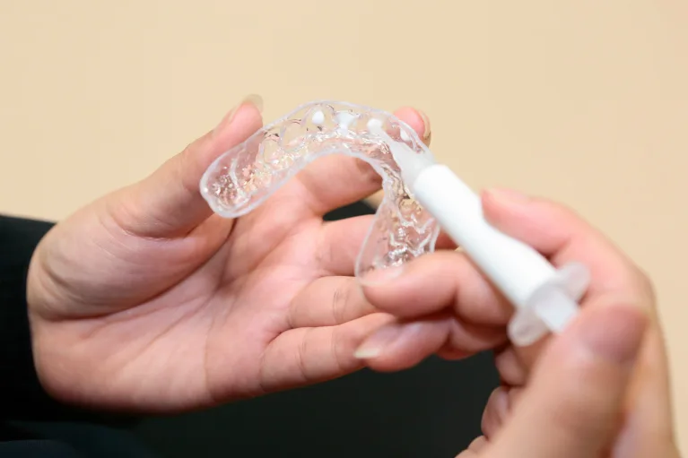 ホワイトニングジェルの注入