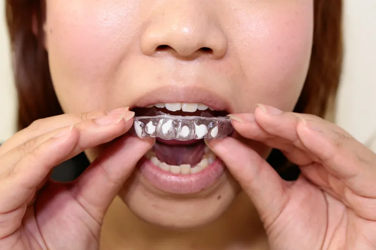 マウストレーの装着